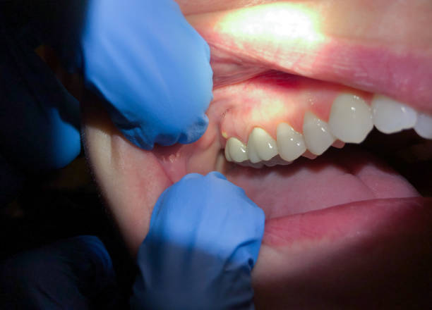 Best Walk-In Emergency Dental Services in Old Mystic, CT
